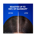 هيد اند شولدرز شامبو شعر ضد القشرة انسيابي وحريري