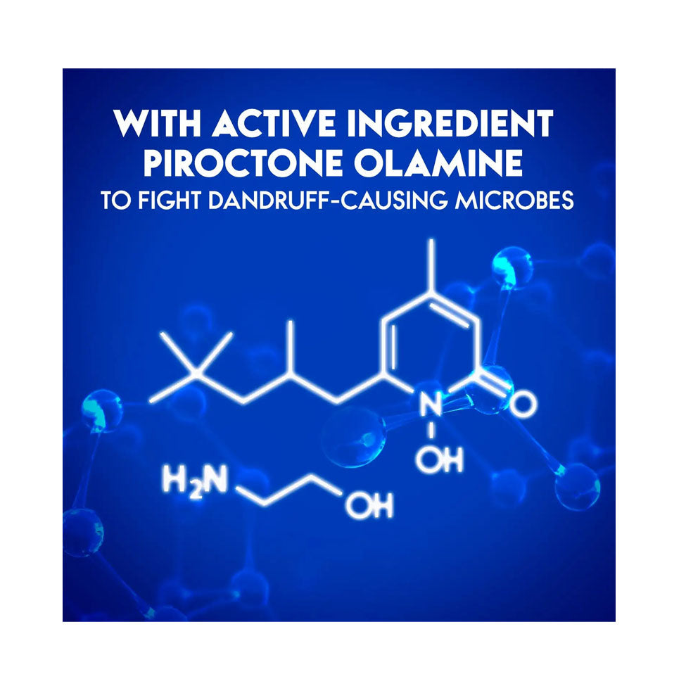 هيد اند شولدرز شامبو شعر ضد القشرة