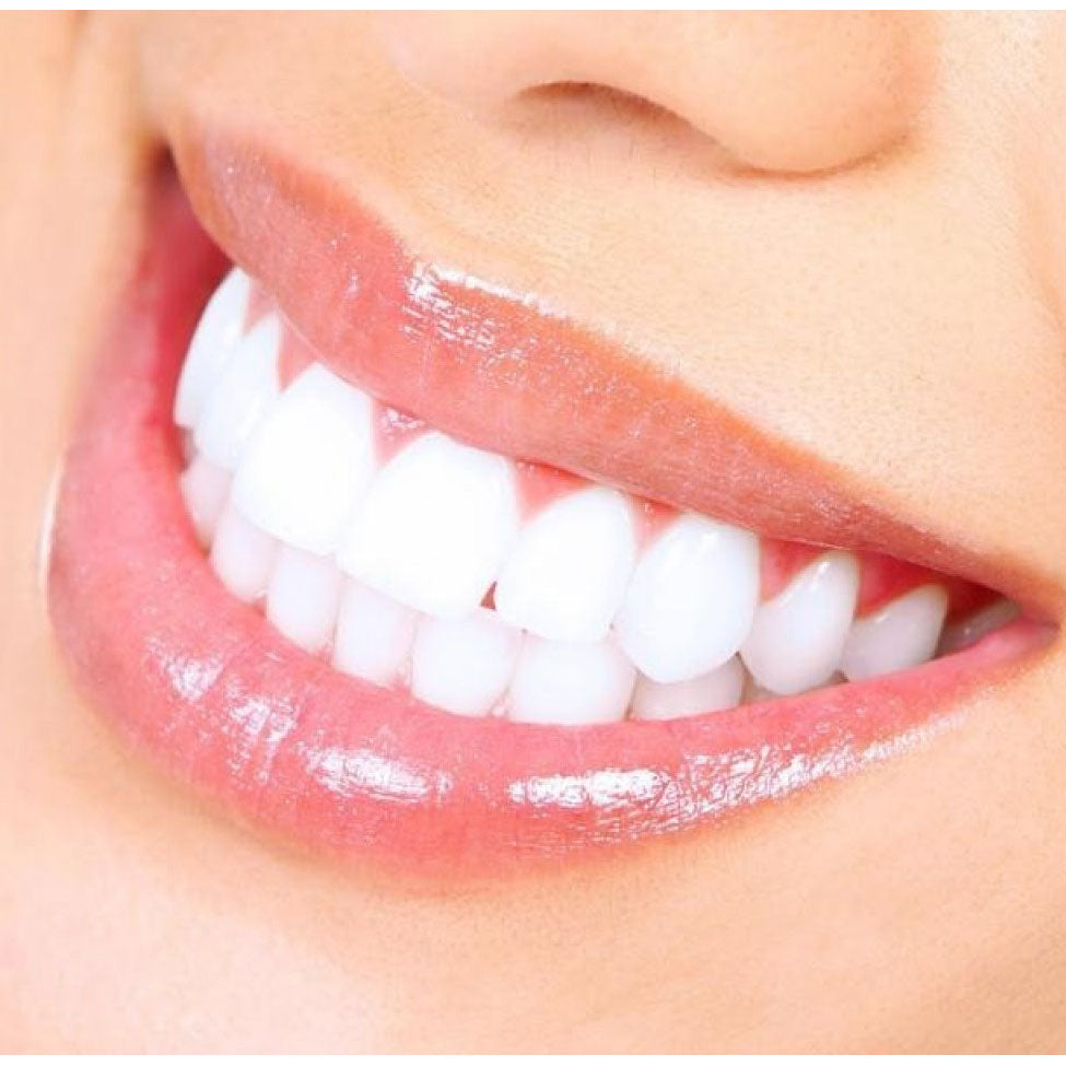 بلانكس معجون أسنان كلاسيك