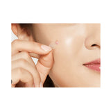 كوسركس لصقات حب الشباب