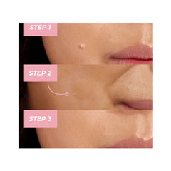 كوسركس لصقات حب الشباب