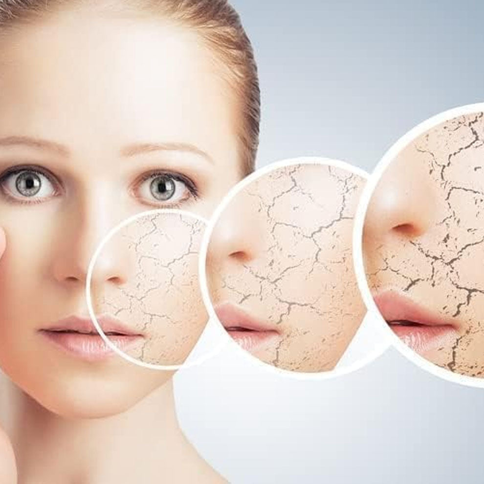 ماكرو بانثينول كريم مرطب لجميع أنواع البشرة 50 جم | صيدلية.كوم.