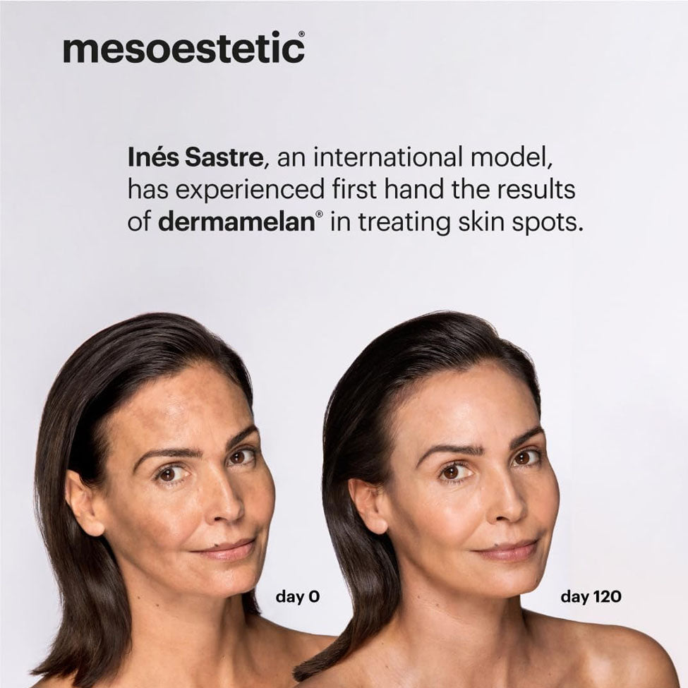 4- علاج البقع الداكنة مجموعة ديرماميلان للعناية بالبشرة