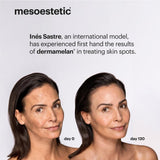 4- علاج البقع الداكنة مجموعة ديرماميلان للعناية بالبشرة