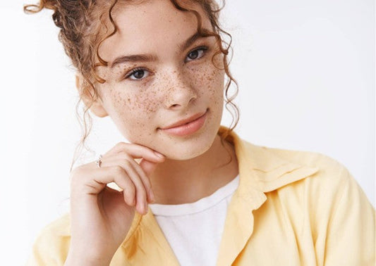 الدليل الشامل: التخلص من النمش.