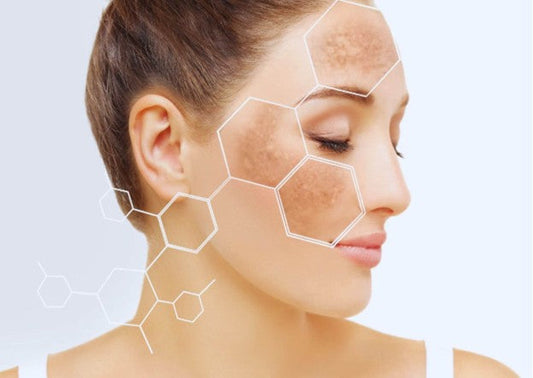 أسباب البقع البيضاء في الوجه.