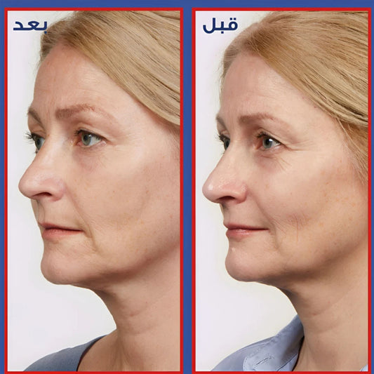 Loreal Revitalift Serum with Pure Retinol Anti-Wrinkle 30 ml