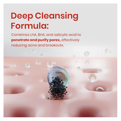 غسول الجسم لعلاج حب الشباب من مومز باث 350 مل |  صيدلية.كوم.