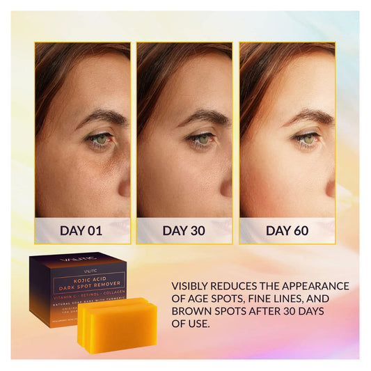 صابون ازالة البقع الداكنة وتفتيحها فاليتيك بالكركم وحمض الكوجيك 100 جم |  صيدلية.كوم.