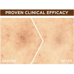 3- سيروم البقع الداكنة جارنييه للوجه اشراقه سريعة فيتامين سي