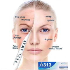 A 313 Anti-Wrinkle Retinol Cream – 50 g