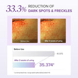 ماري اند ماي كريم العين بحمض الترانيكساميك والجلوتاثيون 30 جرام