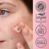 Purederm Care Gel For Clear Skin Free Of Pigmentation 20 ml