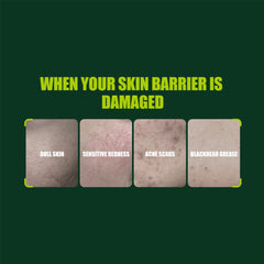 4- سيروم الوجه بالعرقسوس من ايتشن بيوتي 30 مل