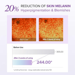 ماري اند ماي كريم العين بحمض الترانيكساميك والجلوتاثيون 30 جرام