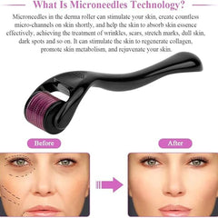 ديرما رولر لعلاج البشرة واثار حب الشباب مقاس 1.5