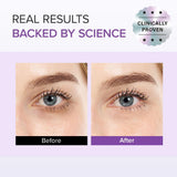 ماري اند ماي كريم العين بحمض الترانيكساميك والجلوتاثيون 30 جرام