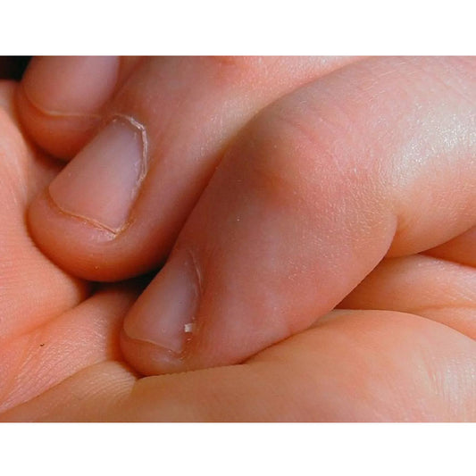 مقص لإزالة الزوائد الجلدية حول الأظافر