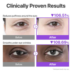Numbuzin Hydrogel patches for under the eye with collagen and NAD+ No. 9+ - 8 grams × 5 pairs