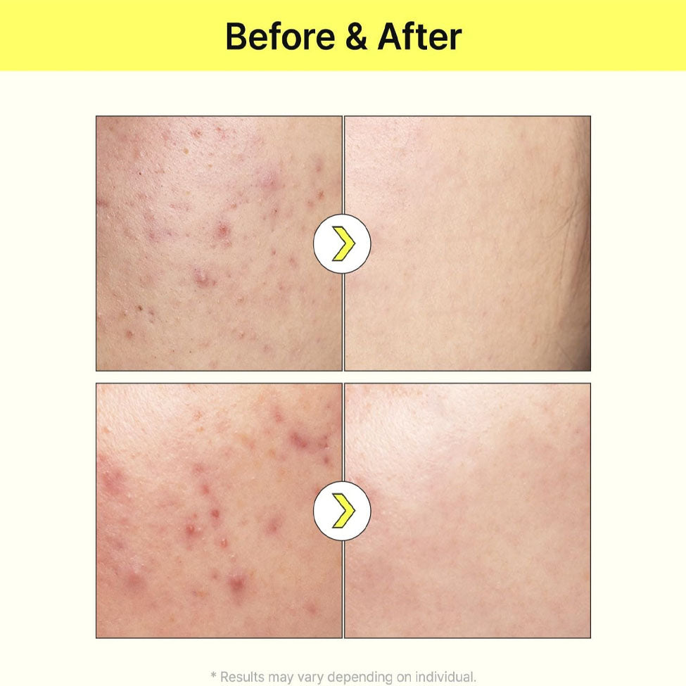 تيام سيروم المكثف لتفتيح وتوحيد لون البشرة مع فيتامين بي 3  40 مل |  صيدلية.كوم.