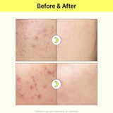 تيام سيروم المكثف لتفتيح وتوحيد لون البشرة مع فيتامين بي 3  40 مل |  صيدلية.كوم.