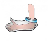 Wide Short Arm Splint From Footrite MN9308 