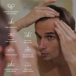 افوجين 5% مينوكسيديل - يرطب البصيلات ويعزز نمو الشعر