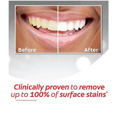 Colgate Toothpaste Optic White Extended White 75 ml