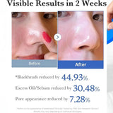 Medicube Zero Pore Swabs for Pore Tightening and Skin Cleansing 70 Pieces