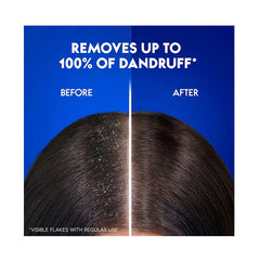 هيد اند شولدرز شامبو ضد القشرة منعش بالنعناع الطبيعي 