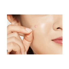 كوسركس لصقات حب الشباب