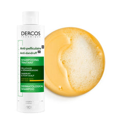 فيتشي شامبو للقشرة والحكة للشعر الجاف 