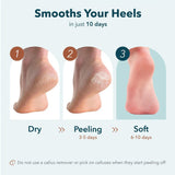 Purederm Instant Softening Heel Mask