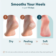 Purederm Instant Softening Heel Mask